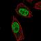 Abhydrolase Domain Containing 16B antibody, NBP2-31761, Novus Biologicals, Immunofluorescence image 