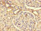 Phosphatidylinositol 3,4,5-trisphosphate-dependent Rac exchanger 2 protein antibody, CSB-PA741122LA01HU, Cusabio, Immunohistochemistry paraffin image 
