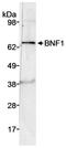 Chordin Like 2 antibody, A300-378A, Bethyl Labs, Western Blot image 