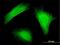 Twinfilin Actin Binding Protein 1 antibody, H00005756-M05, Novus Biologicals, Immunofluorescence image 