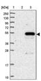 Family With Sequence Similarity 222 Member A antibody, PA5-59093, Invitrogen Antibodies, Western Blot image 
