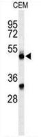 PFC antibody, AP50880PU-N, Origene, Western Blot image 