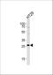 Nicotinamide N-Methyltransferase antibody, A02676-1, Boster Biological Technology, Western Blot image 