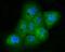 P21 (RAC1) Activated Kinase 2 antibody, A01419-3, Boster Biological Technology, Immunocytochemistry image 