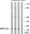 Mitochondrial Ribosomal Protein L32 antibody, GTX87619, GeneTex, Western Blot image 