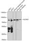 Arachidonate Lipoxygenase 3 antibody, GTX65902, GeneTex, Western Blot image 
