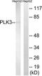 PRK antibody, TA313645, Origene, Western Blot image 