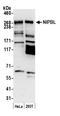 NIPBL Cohesin Loading Factor antibody, A301-779A, Bethyl Labs, Western Blot image 