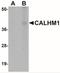 Calcium Homeostasis Modulator 1 antibody, NBP1-77112, Novus Biologicals, Western Blot image 
