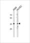 Homeobox protein Hox-B5 antibody, 62-490, ProSci, Western Blot image 