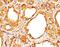Thyroglobulin antibody, orb248559, Biorbyt, Immunohistochemistry paraffin image 