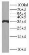 Partner Of NOB1 Homolog antibody, FNab06589, FineTest, Western Blot image 