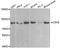 CDH2 antibody, TA327492, Origene, Western Blot image 