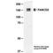 FA Complementation Group D2 antibody, MA1-23333, Invitrogen Antibodies, Western Blot image 