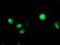 Cytochrome P450 Family 2 Subfamily C Member 9 antibody, MA5-25745, Invitrogen Antibodies, Immunocytochemistry image 