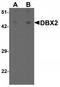 Developing Brain Homeobox 2 antibody, TA320189, Origene, Western Blot image 