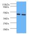 Arginine Vasopressin Receptor 1B antibody, MBS1489976, MyBioSource, Western Blot image 
