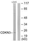 Cyclin Dependent Kinase Inhibitor 3 antibody, LS-C198789, Lifespan Biosciences, Western Blot image 