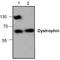 Dystrophin antibody, TA318925, Origene, Western Blot image 
