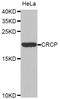 CGRP Receptor Component antibody, A4657, ABclonal Technology, Western Blot image 