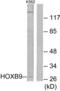 Homeobox B9 antibody, LS-C118799, Lifespan Biosciences, Western Blot image 