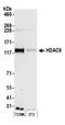 Histone Deacetylase 6 antibody, A301-342A, Bethyl Labs, Western Blot image 