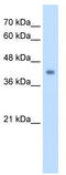 Glutaryl-CoA Dehydrogenase antibody, TA332367, Origene, Western Blot image 
