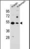 Solute Carrier Family 16 Member 11 antibody, orb376095, Biorbyt, Western Blot image 