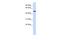 Cytochrome B561 antibody, A10618, Boster Biological Technology, Western Blot image 