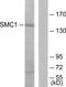 Structural Maintenance Of Chromosomes 1A antibody, TA312312, Origene, Western Blot image 
