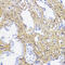 Collagen Type I Alpha 1 Chain antibody, 15-039, ProSci, Immunohistochemistry paraffin image 