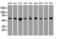 Nuclear Receptor Binding Protein 1 antibody, M07309-1, Boster Biological Technology, Western Blot image 