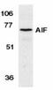 Apoptosis Inducing Factor Mitochondria Associated 1 antibody, TA306028, Origene, Western Blot image 