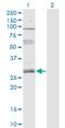 Zinc Finger Protein 138 antibody, H00007697-M01, Novus Biologicals, Western Blot image 