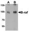 B-Raf Proto-Oncogene, Serine/Threonine Kinase antibody, TA326637, Origene, Western Blot image 
