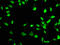 Forkhead Box P1 antibody, LS-C317913, Lifespan Biosciences, Immunofluorescence image 