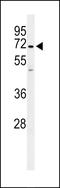 Protein Phosphatase 1 Regulatory Subunit 18 antibody, LS-C163693, Lifespan Biosciences, Western Blot image 