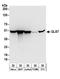 Dihydrolipoamide S-Succinyltransferase antibody, A304-309A, Bethyl Labs, Western Blot image 