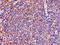 Ligand Of Numb-Protein X 1 antibody, LS-C678498, Lifespan Biosciences, Immunohistochemistry paraffin image 