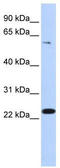 Zinc Finger Protein 460 antibody, TA339705, Origene, Western Blot image 