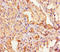 Filaggrin antibody, A55499-100, Epigentek, Immunohistochemistry paraffin image 