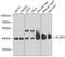 Acyl-CoA Dehydrogenase Short Chain antibody, 13-328, ProSci, Western Blot image 