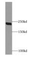 Citron Rho-interacting kinase antibody, FNab01720, FineTest, Western Blot image 