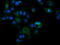 Phosphatidylinositol-4,5-bisphosphate 3-kinase catalytic subunit gamma isoform antibody, LS-C174228, Lifespan Biosciences, Immunofluorescence image 