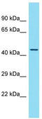Homeobox protein DBX1 antibody, TA341739, Origene, Western Blot image 