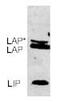 CCAAT Enhancer Binding Protein Beta antibody, ab15050, Abcam, Western Blot image 