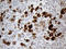 Pancreatic Lipase antibody, LS-C792893, Lifespan Biosciences, Immunohistochemistry paraffin image 