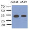 Phosducin Like 3 antibody, GTX57608, GeneTex, Western Blot image 