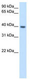 Integrin Subunit Beta 1 Binding Protein 2 antibody, TA346462, Origene, Western Blot image 