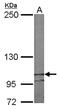 Spectrin Repeat Containing Nuclear Envelope Protein 2 antibody, PA5-78438, Invitrogen Antibodies, Western Blot image 